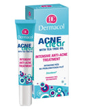 AcneClear Intensive Anti-Acne Treatment 15ml point treatment for acne-prone skin